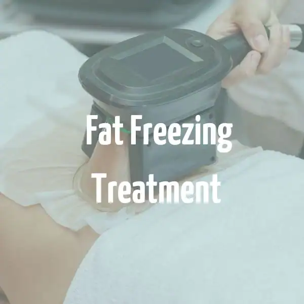 fat freezing treatment West Midlands