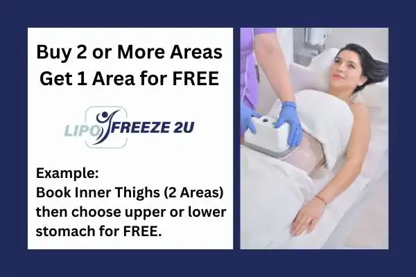 fat freezing prices West Midlands