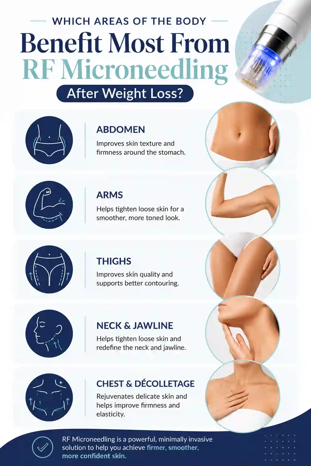 Which Areas of the Body Benefit Most From RF Microneedling After Weight Loss West Midlands